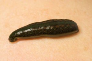 Hirudo medicinalis: Lægeiglen