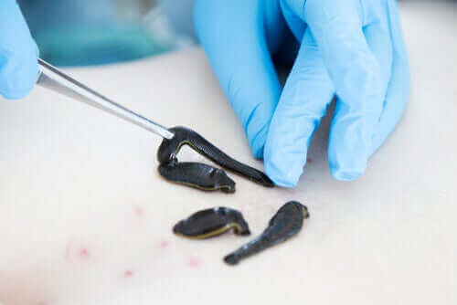 brug en pincet til at tage iglen med