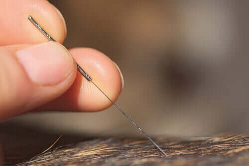 Nærbillede af akupunkturnål