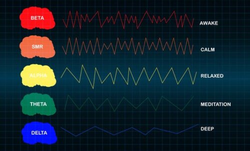 Ændring i hjerneaktivitet kan registreres i et elektroencefalogram og genkendes af udseendet af de bølger, det producerer