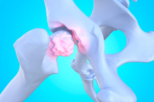 Illustration af led hos hunde